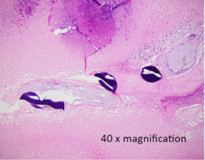 Rabbit HCC Model (40 x magnification)